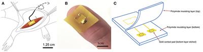 Polyimide Electrode-Based Electrical Stimulation Impedes Early Stage Muscle Graft Regeneration